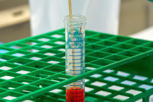  &copy;&nbsp;Фото CDC, unsplash.com