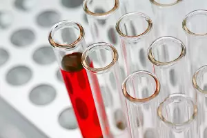 Анализ в лаборатории &copy;&nbsp;Фото Bill Oxford, unsplash.com