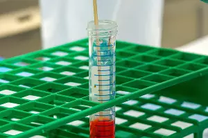  &copy;&nbsp;Фото CDC, unsplash.com