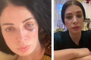  &copy;&nbsp;Коллаж из скриншотов из телеграм-каналов &laquo;Кавказ без матери&raquo; и &laquo;ЧП Краснодар ™&raquo;