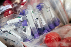 Анализ крови в лаборатории © Фото freestocks, unsplash.com