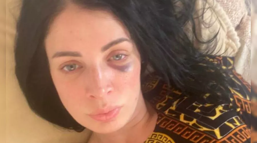  &copy;&nbsp;Фото из телеграм-канала правозащитного проекта &laquo;Кавказ без матери&raquo;