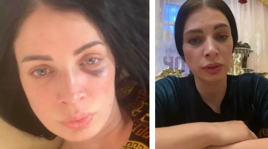  &copy;&nbsp;Коллаж из скриншотов из телеграм-каналов &laquo;Кавказ без матери&raquo; и &laquo;ЧП Краснодар ™&raquo;