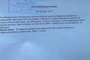 Результаты рентгена в ККБ № 2 &copy;&nbsp;Фото Никиты Быкова, Юга.ру