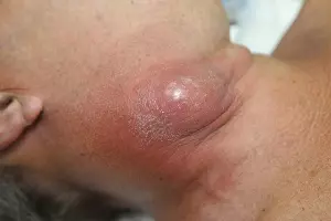  &copy;&nbsp;Фото пресс-службы минздрава Краснодарского края