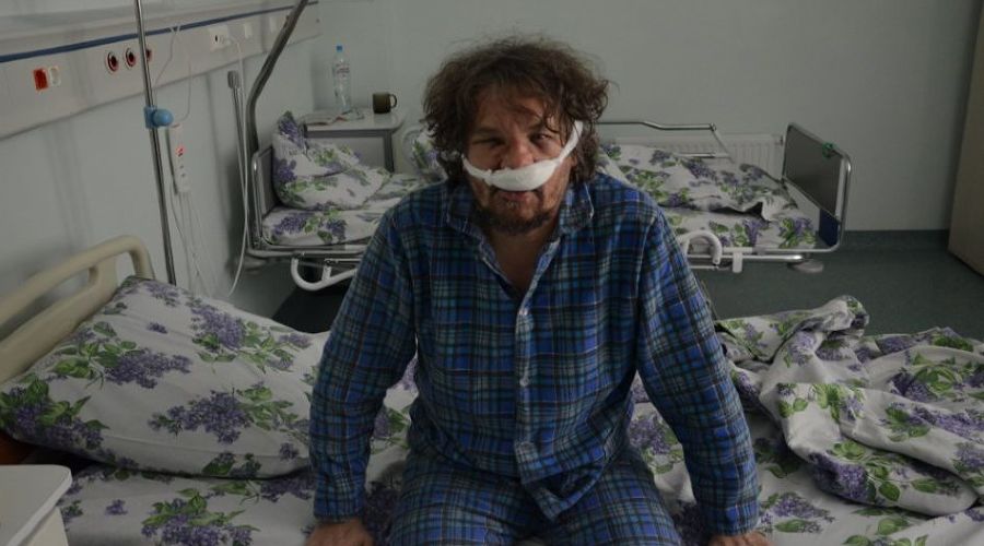 Андрей Рудомаха после нападения © Фото «Экологической вахты по Северному Кавказу»