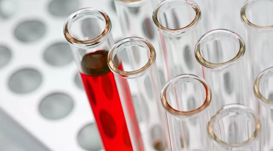 Анализ в лаборатории &copy;&nbsp;Фото Bill Oxford, unsplash.com