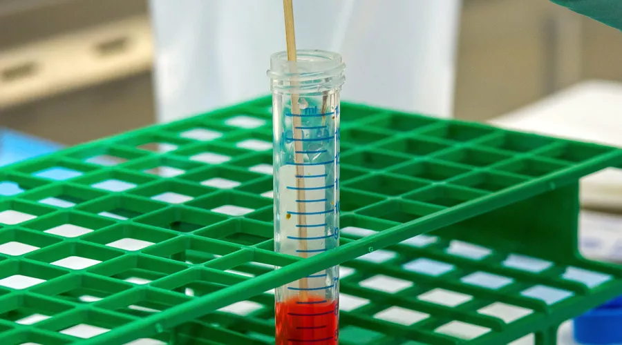  &copy;&nbsp;Фото CDC, unsplash.com