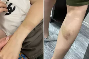  &copy;&nbsp;Коллаж из скриншотов фото из телеграм-канала &laquo;Осторожно, новости&raquo;